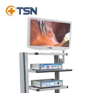 سیستم اندوویژن